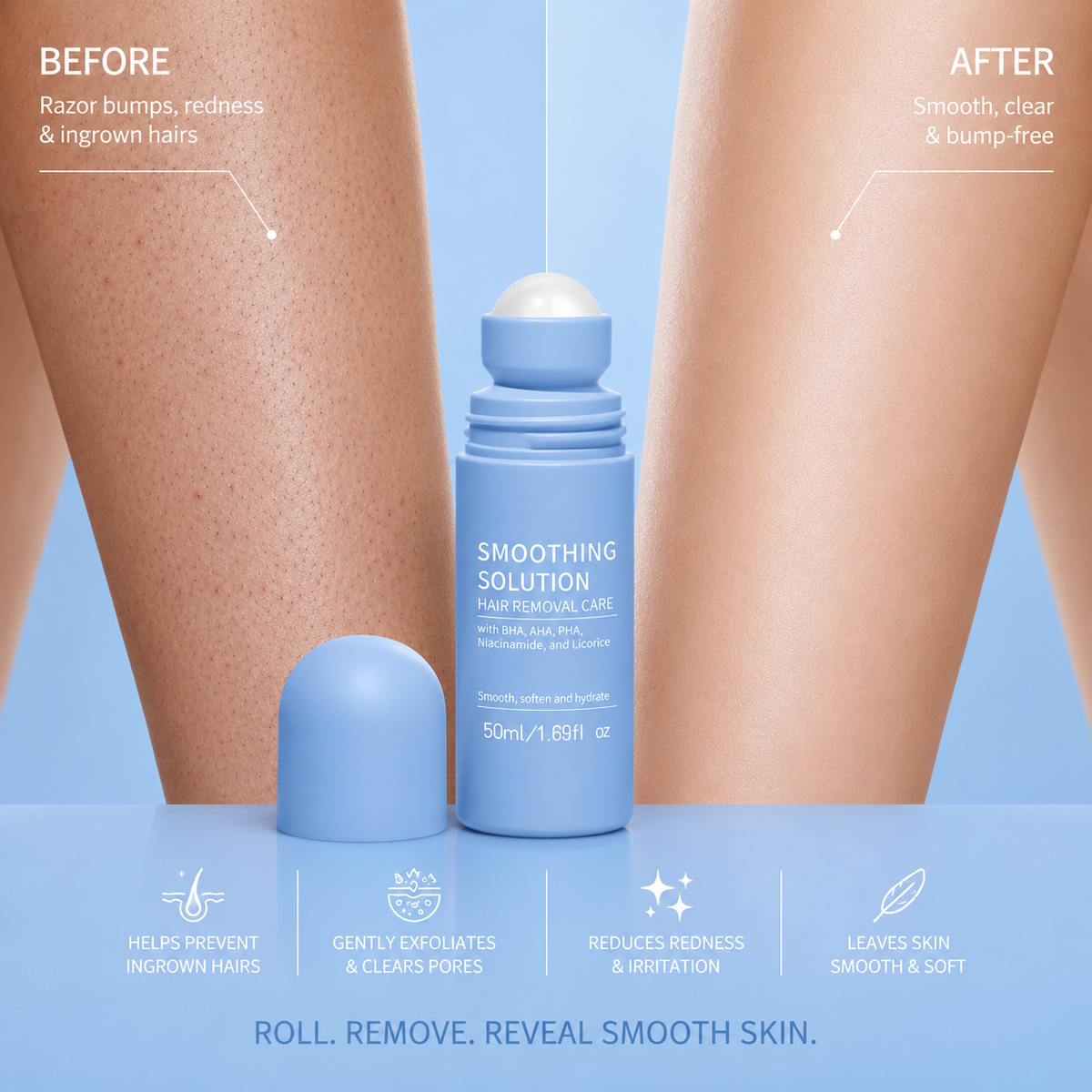 Veloura Ingrown Hair Roller
